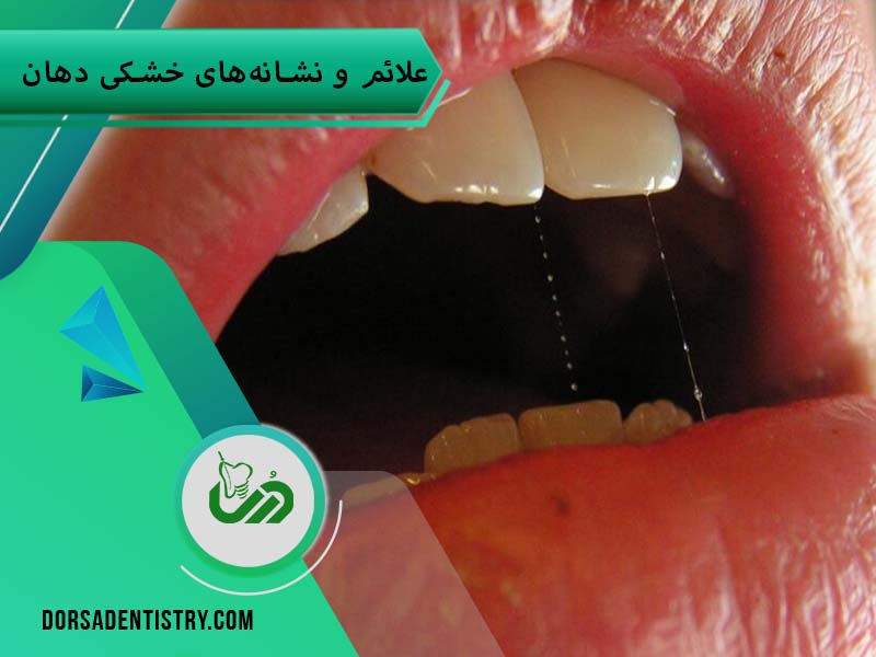 علائم خشکی دهان