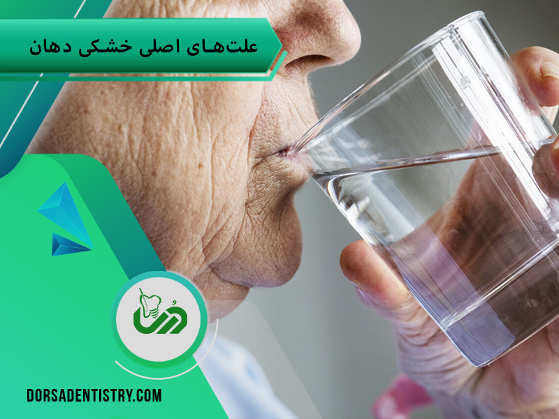 علت خشکی دهان