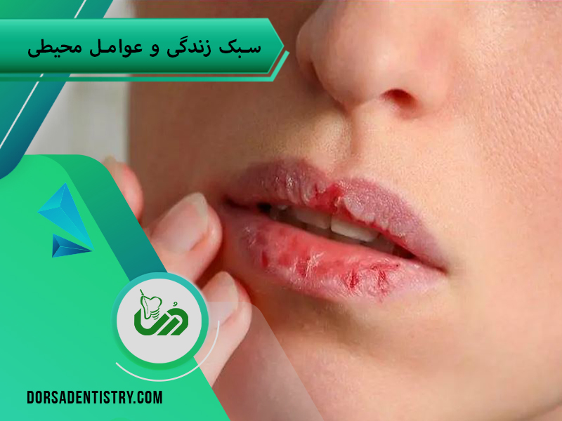 علل خشکی دهان