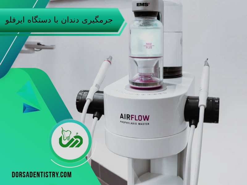 جرمگیری با دستگاه ایرفلو دندانپزشکی