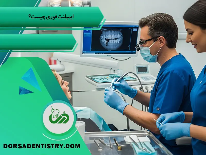 ایمپلنت فوری چیست؟