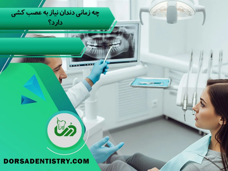 چه زمانی دندان نیاز به عصب کشی دارد؟