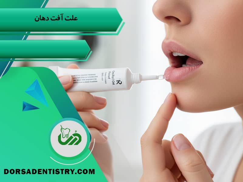 علت آفت دهان