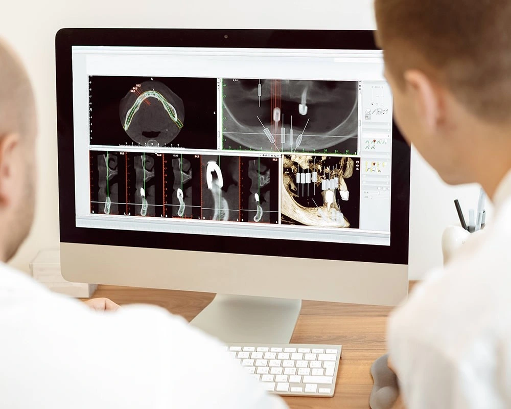 ایمپلنت دیجیتال در مشهد