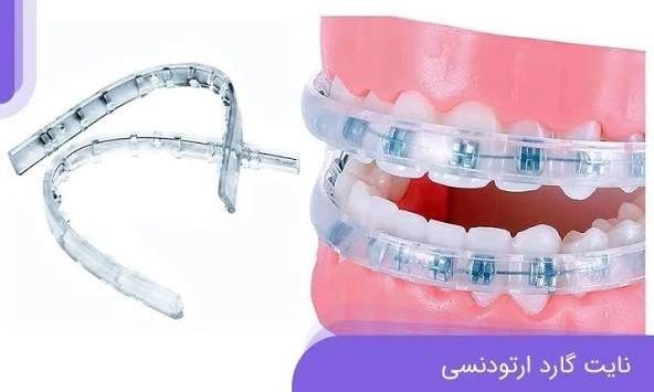 نایت گارد ارتودنسی
